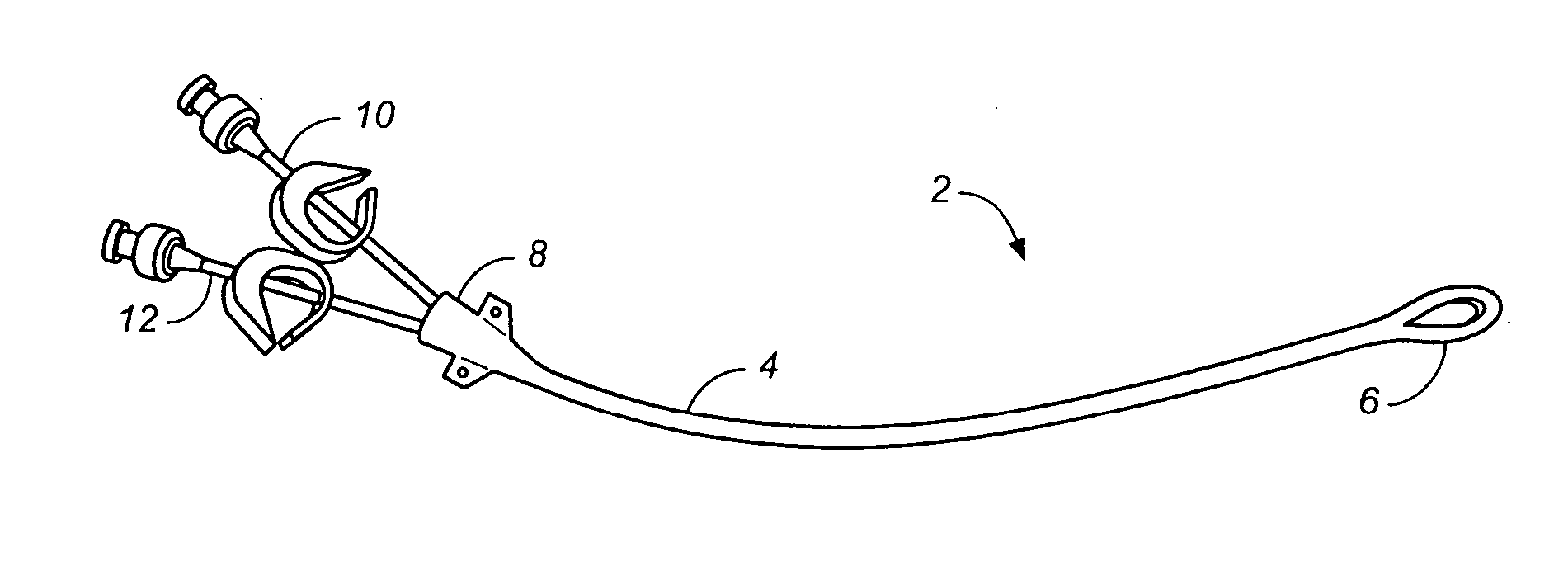 Loop-tip catheter
