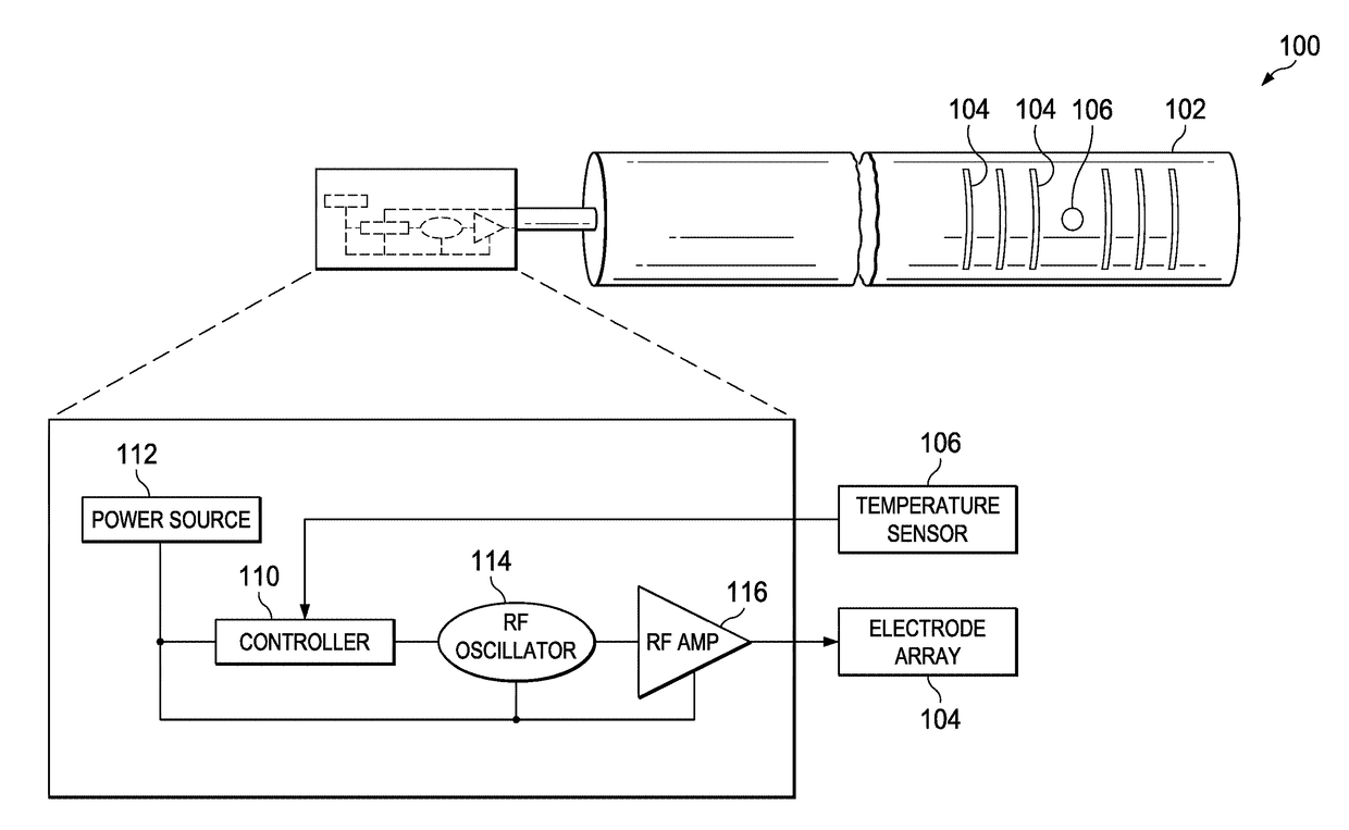 RF Energy Delivery Device for Vaginal Tightening