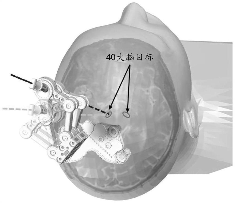 Robotic stereotactic system for mri-guided neurosurgery
