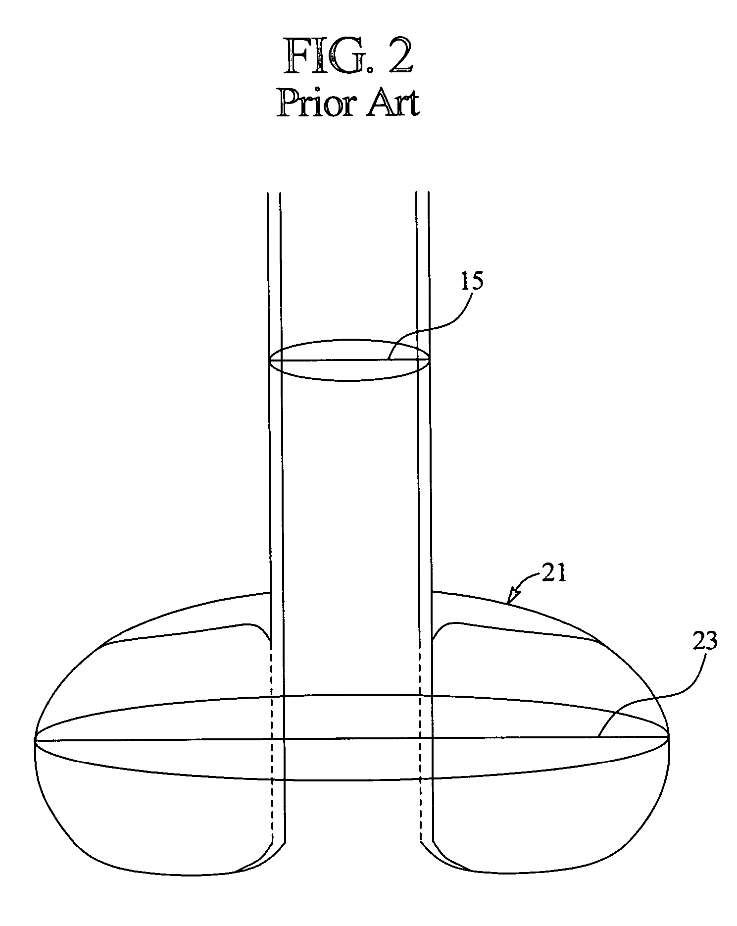 System and method for securing a medical access device
