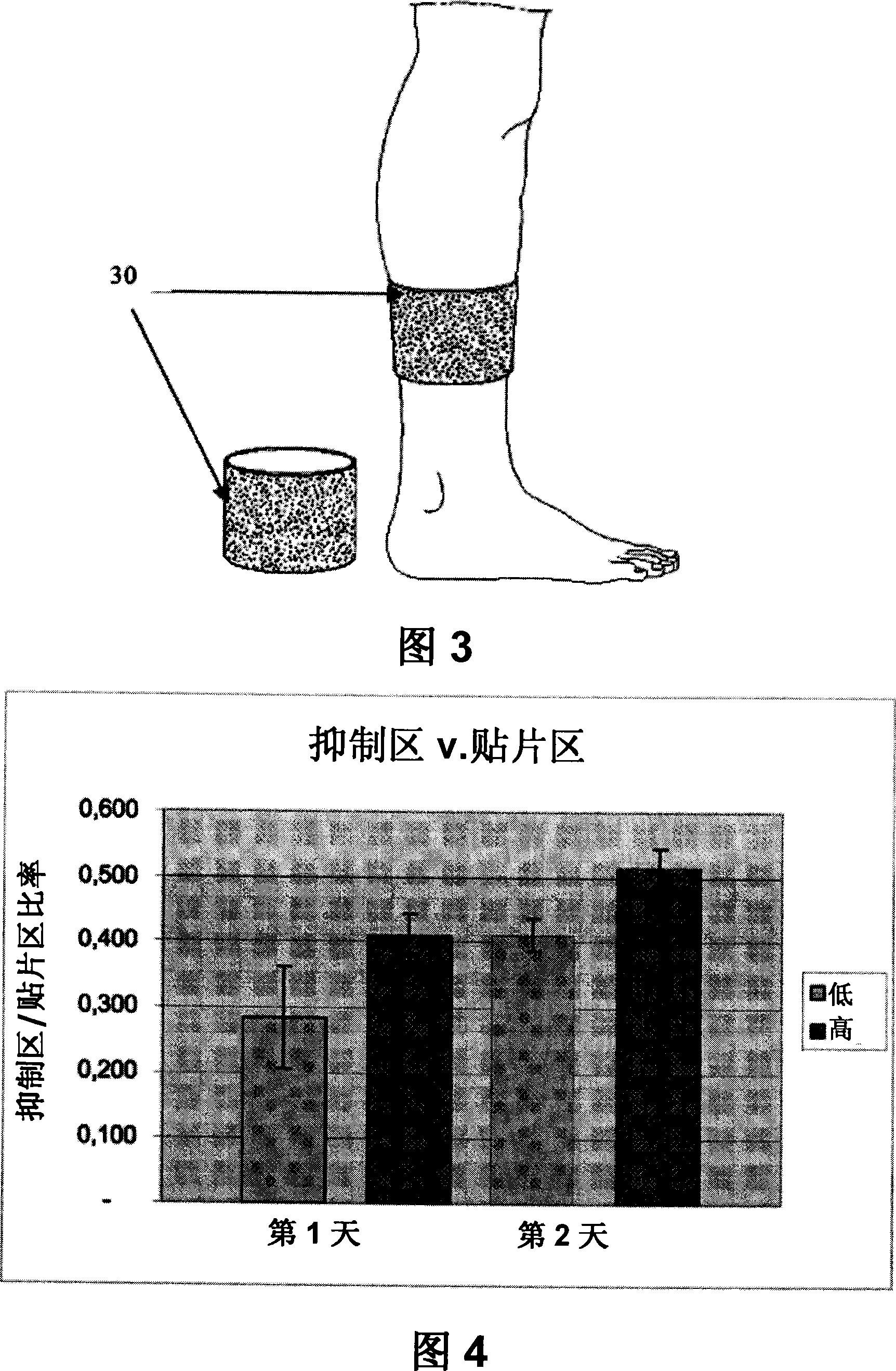 Treatment and pre-treatment device comprising nitric oxide and producing method thereof
