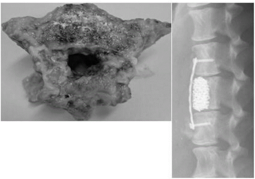 Bone repairing biological ceramic support material prepared on basis of dry laying-sintering technology and preparation method thereof