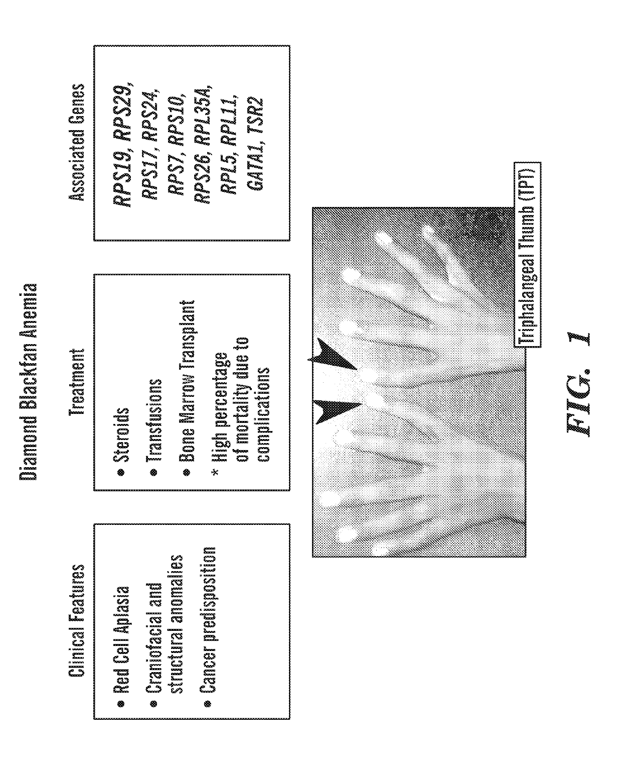 Calmodulin inhibitors, chk2 inhibitors and rsk inhibitors for the treatment of ribosomal disorders and ribosomapathies