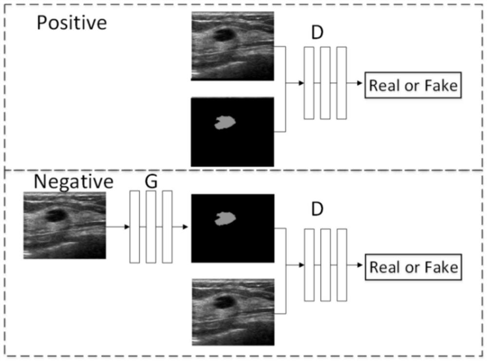 Thyroid nodule invasiveness prediction method based on deep learning segmentation network