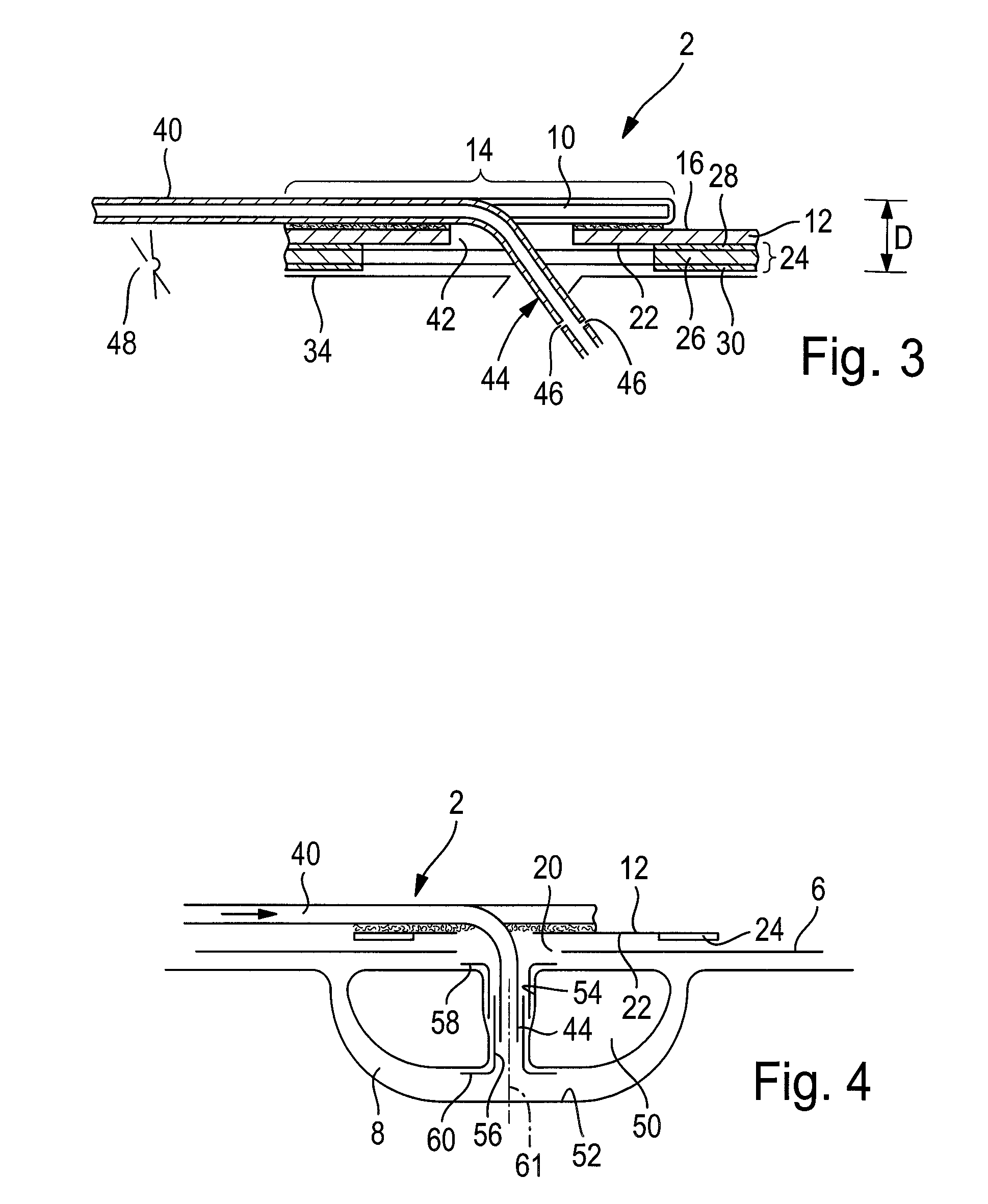 Wound support for use in vacuum therapy of wounds