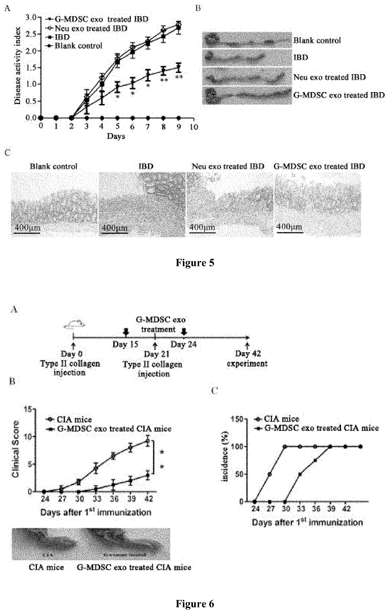 Exosomes sourced from granulocytic myeloid-derived suppressor cells and application thereof