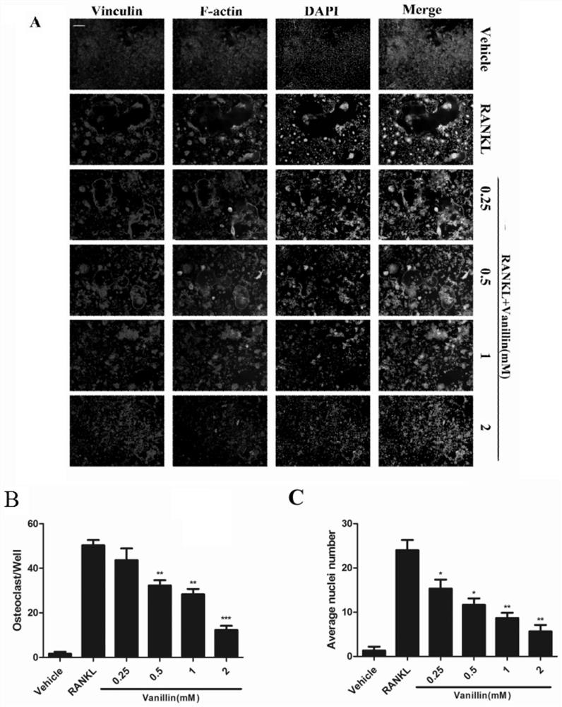 Application of vanillin in the preparation of medicines for treating/preventing bone metabolic diseases