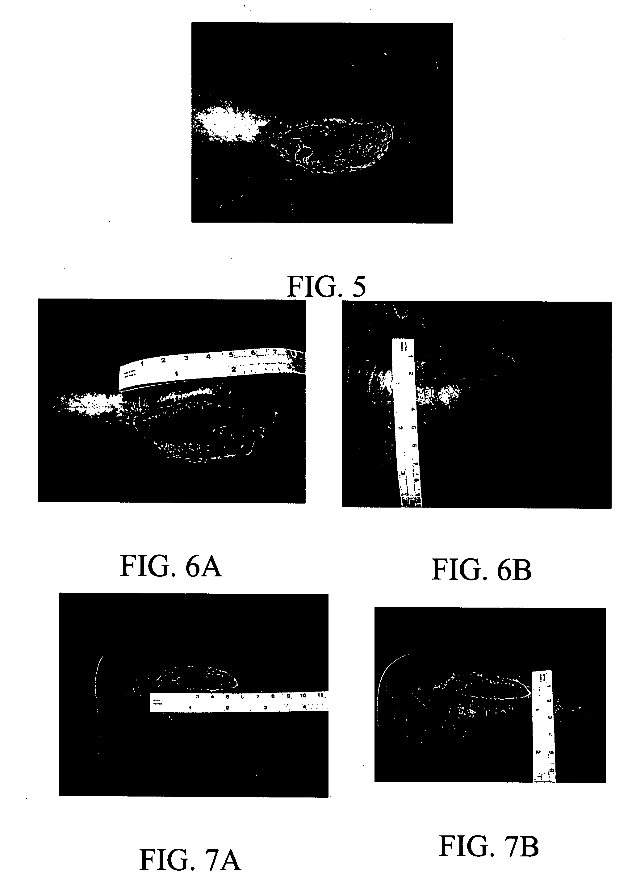 Materials and methods for wound treatment