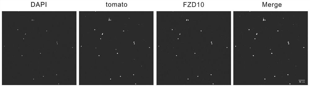 Method for separating inner ear FZD10 positive glial cells