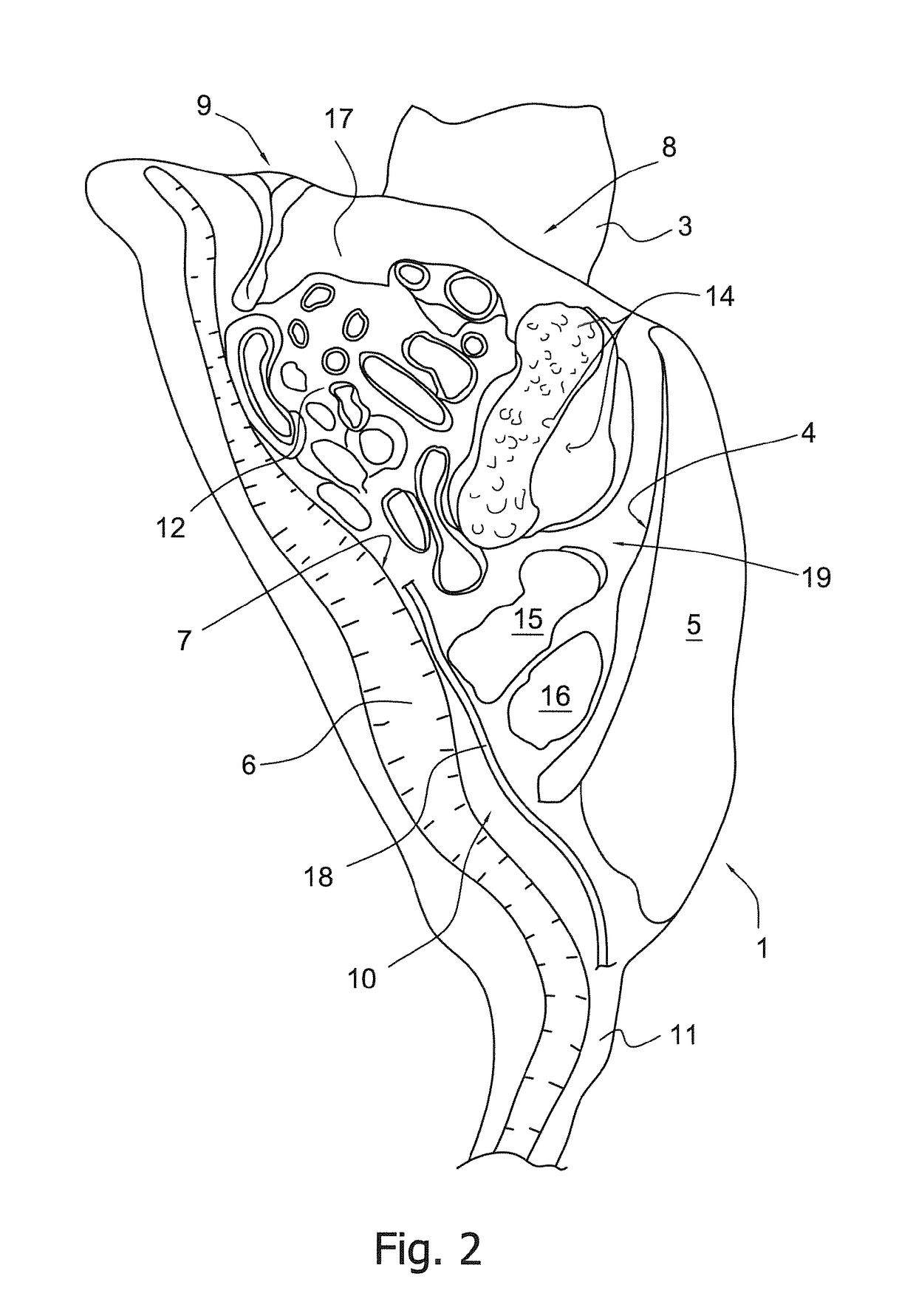 Method and device for evisceration of slaughtered poultry