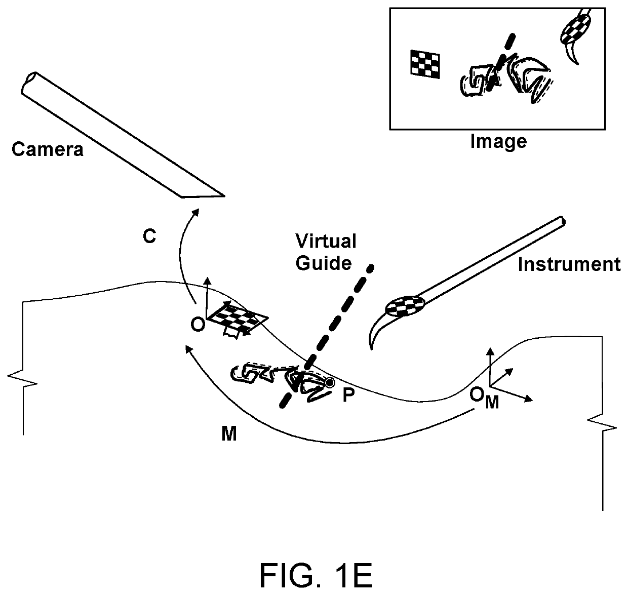 Methods and systems for computer-aided surgery using intra-operative video acquired by a free moving camera