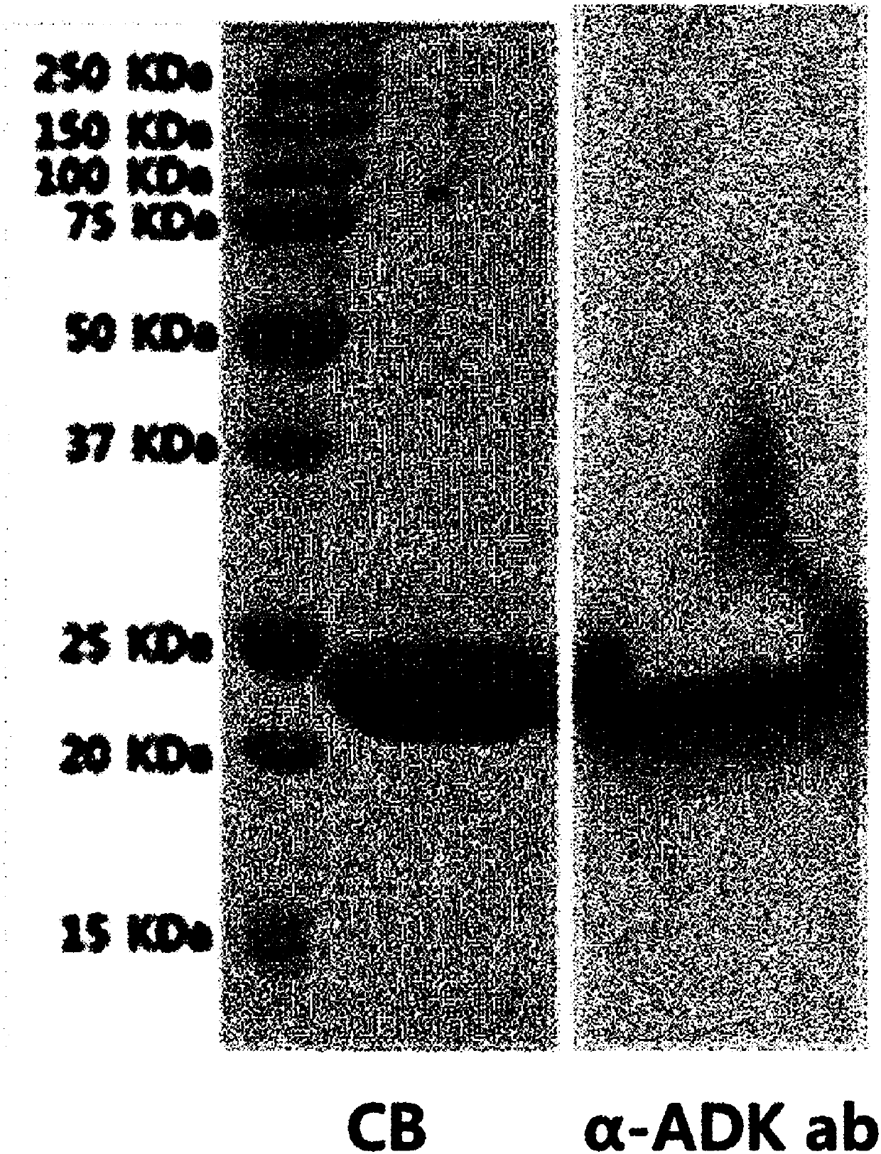 Antibacterial composition for combating carbapenem-resistant gram-negative bacteria comprising ADK protein as active ingredient