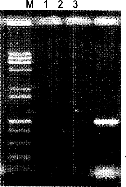 Refractory metal prolease gene engineering bacterium and acquiring method therefor