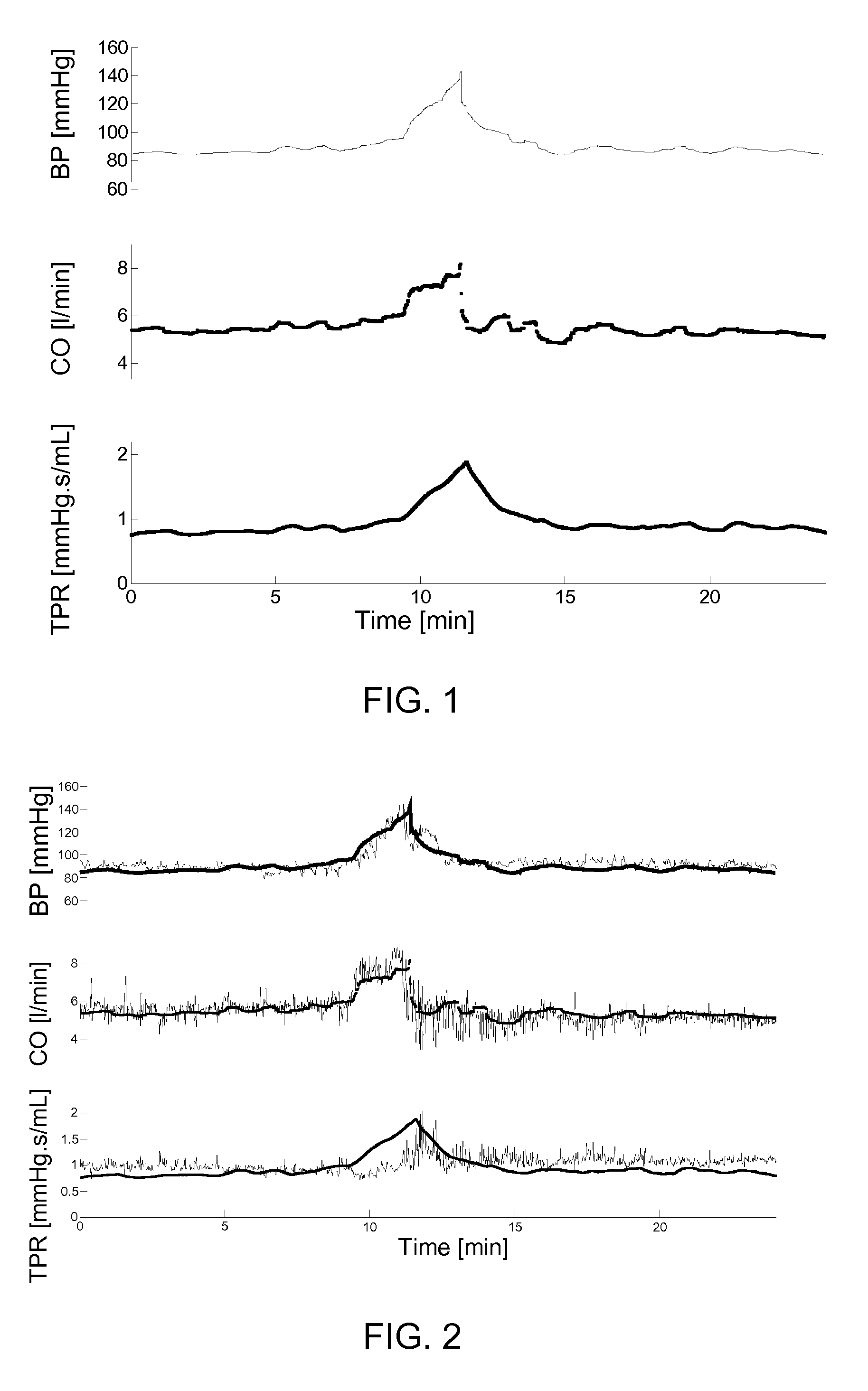 Method and apparatus for a continuous non-invasive and non-obstrusive monitoring of blood pressure