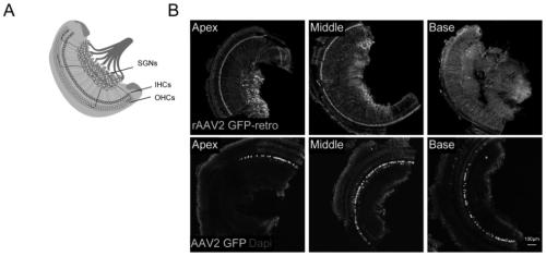 Application of retrograde recombinant adeno-associated virus type 2 in infected spiral neurons