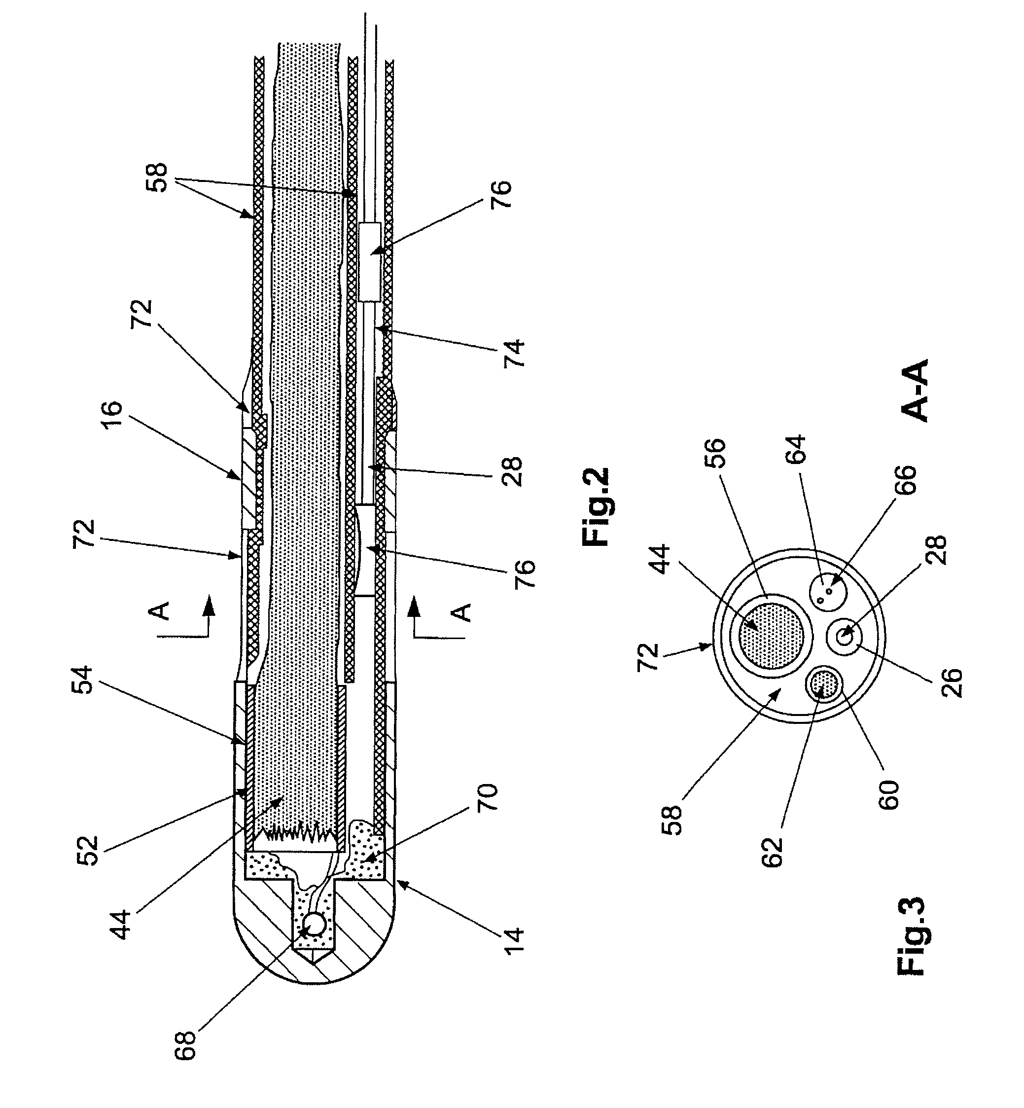 Electrode catheter for the electrotherapy of cardiac tissue