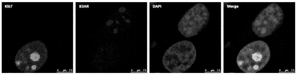 Monoclonal antibody for human ADRB3 (beta3 adrenoceptor) and application of monoclonal antibody to disease diagnosis and treatment