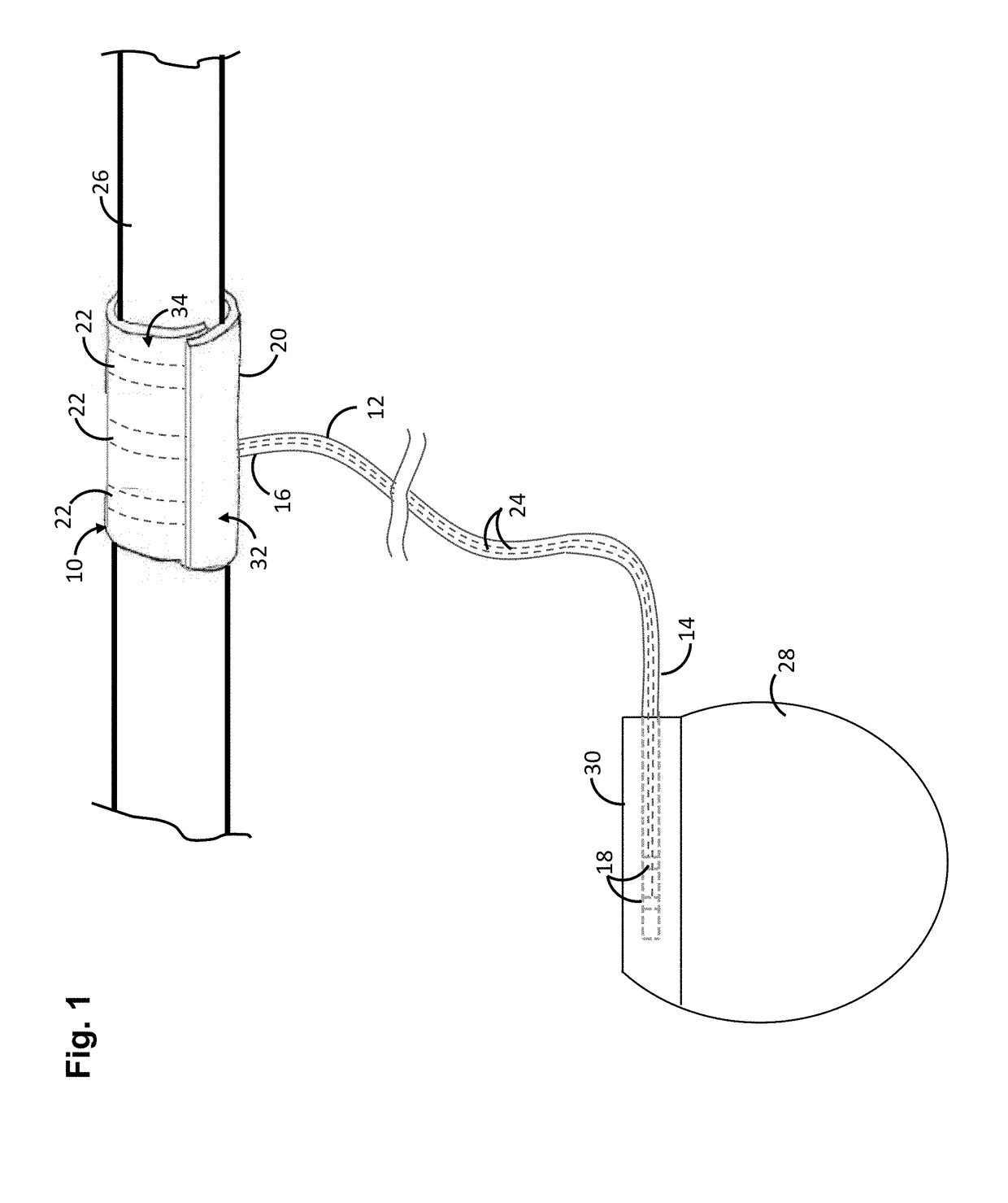 Self-expanding nerve cuff electrode