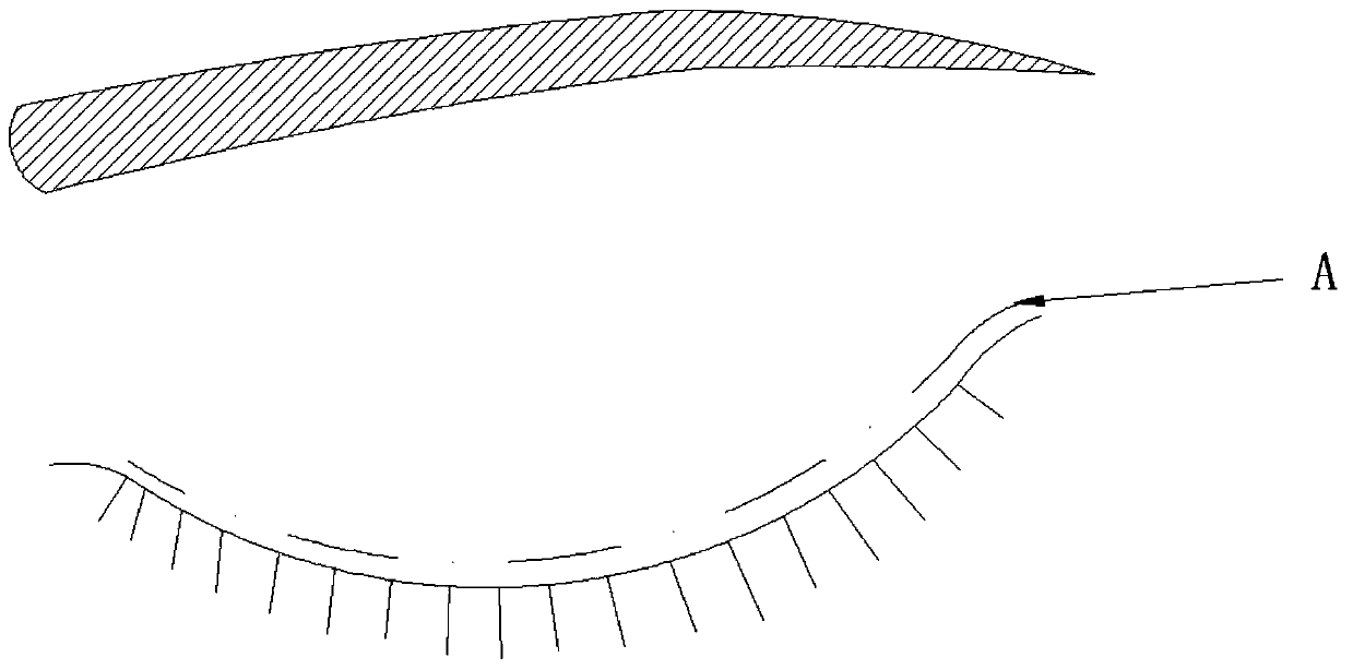 Operating method for double eyelid plasty