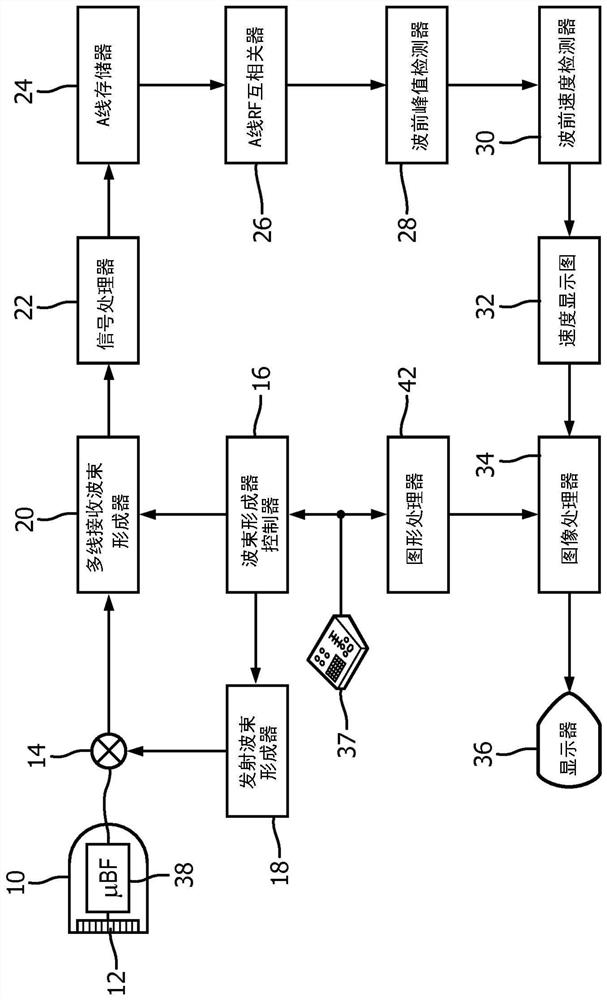 Ultrasound system for shear wave imaging in three dimensions