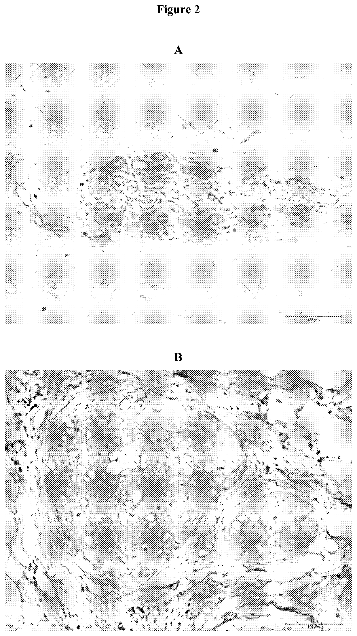 Method for isolating and detecting cancer stem cells