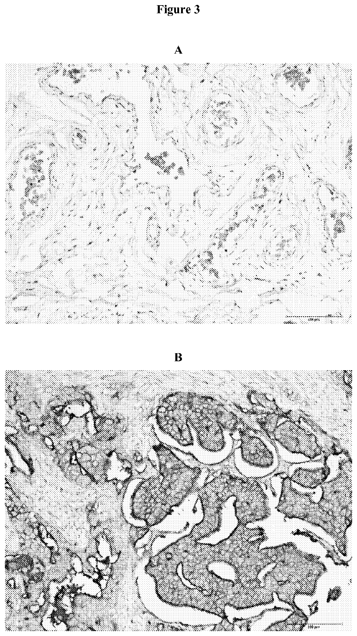 Method for isolating and detecting cancer stem cells