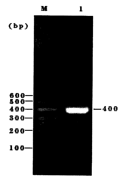 Medicament containing natriuretic peptide gene as well as preparation method and application thereof