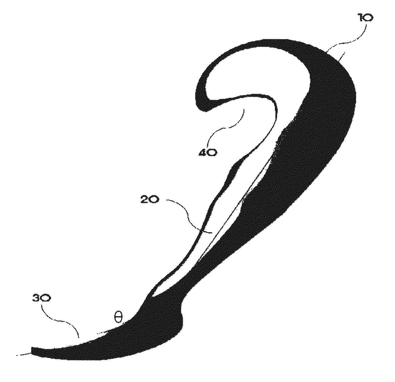 Infra-obturator tension transfer device