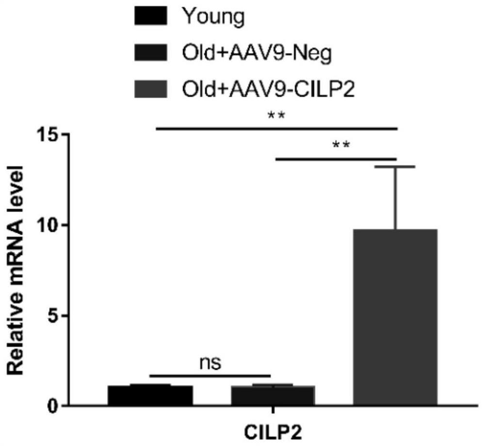 Application of cilp2 in the preparation of drugs for improving cardiac aging and cardiac hypertrophy