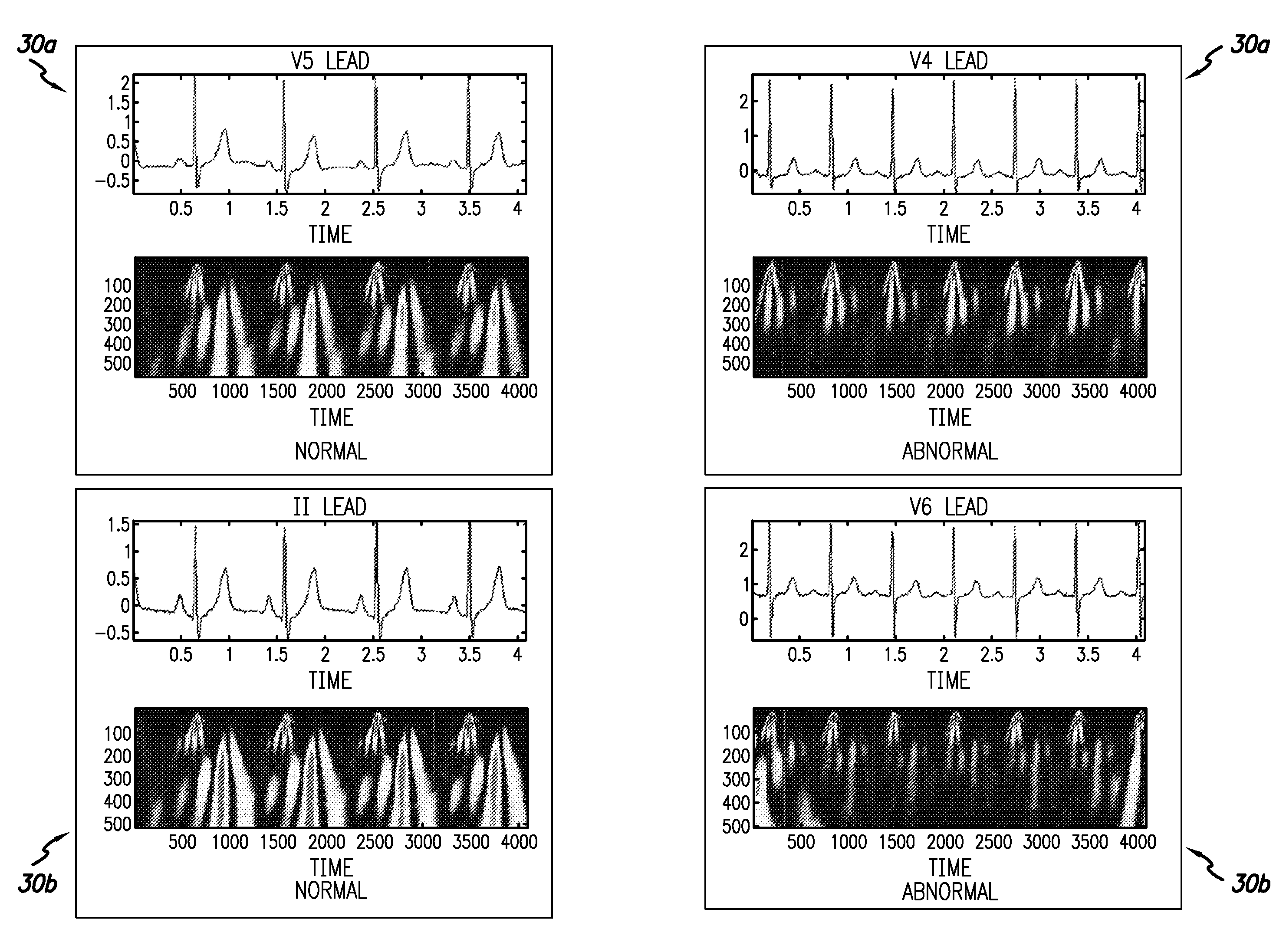 System and method for scanning the heart