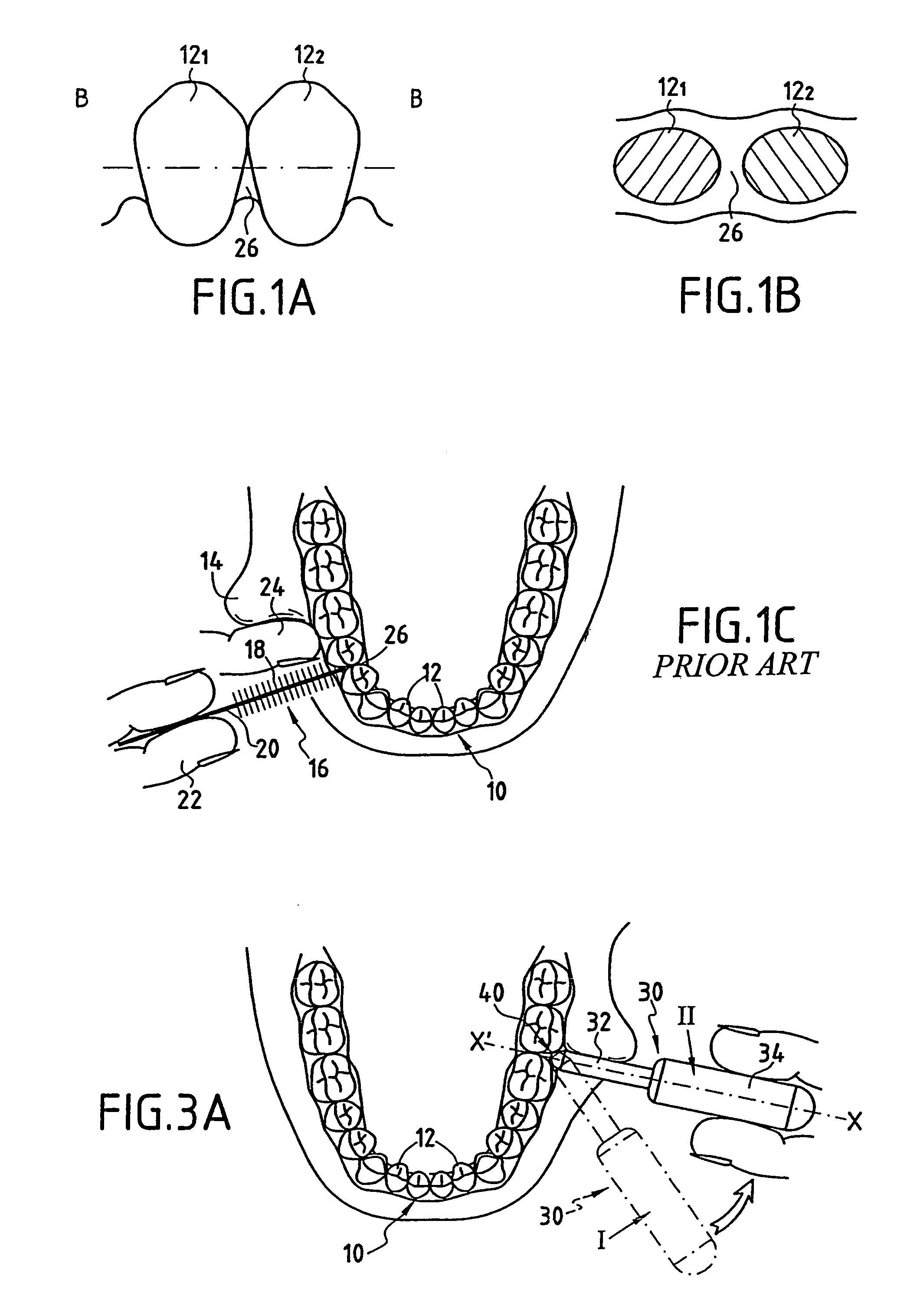Device for cleaning interdental spaces
