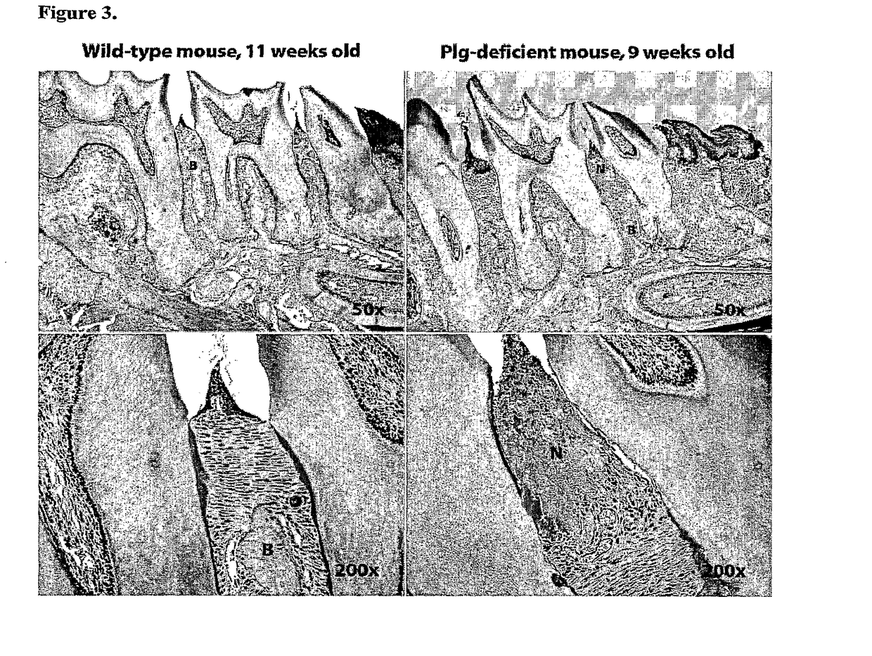 Drug target for preventing and treating periodontal disease, improving healing of periodontal wounds and promoting oral health