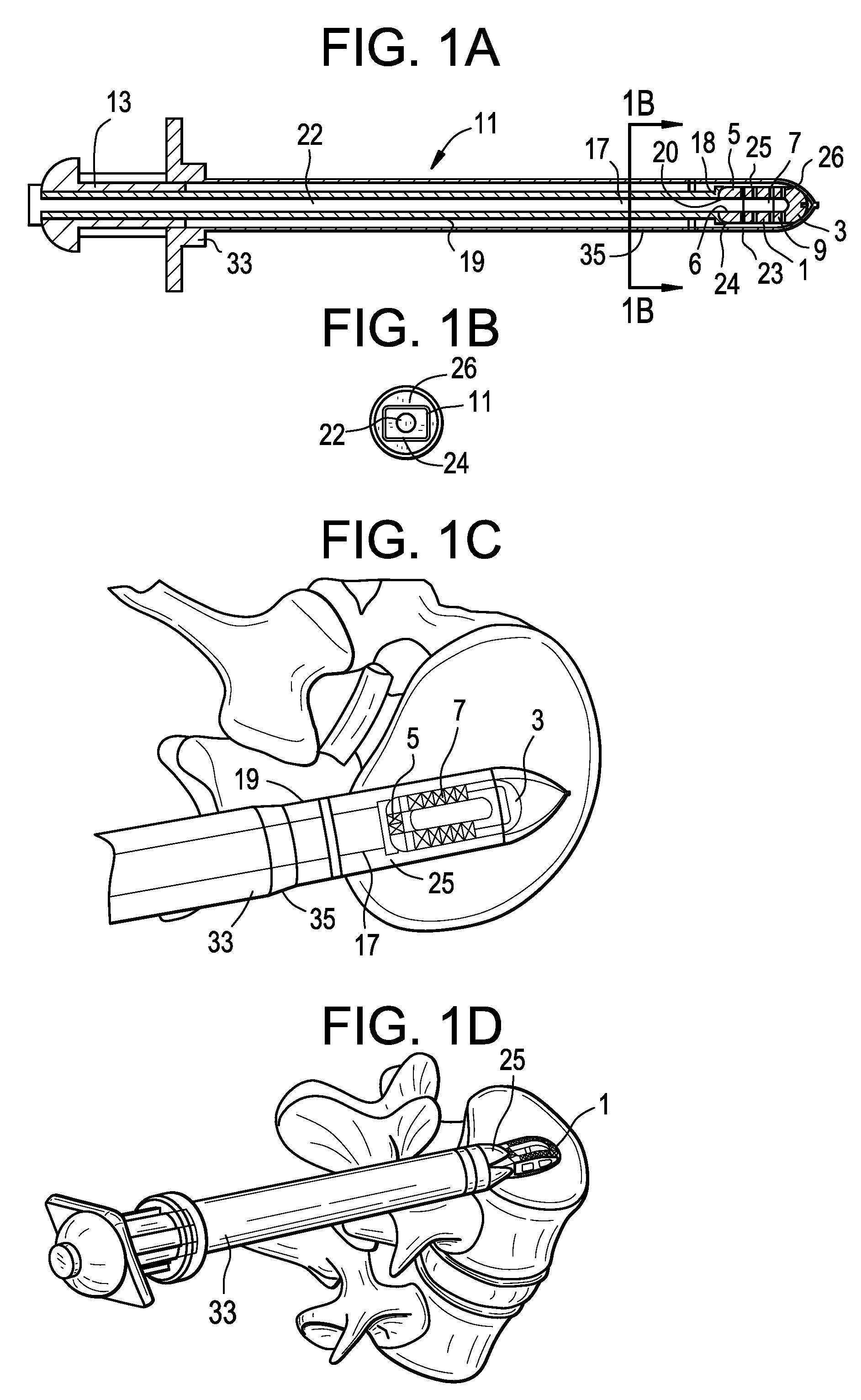 Enhanced cage insertion device