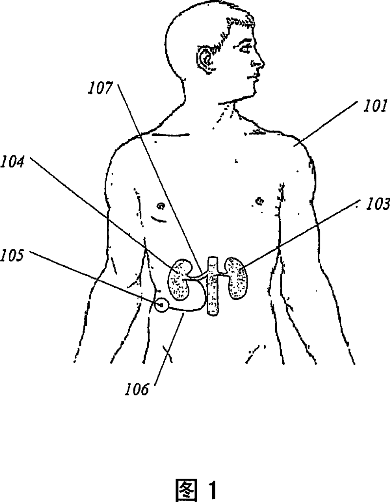 Methods and devices for renal nerve blocking
