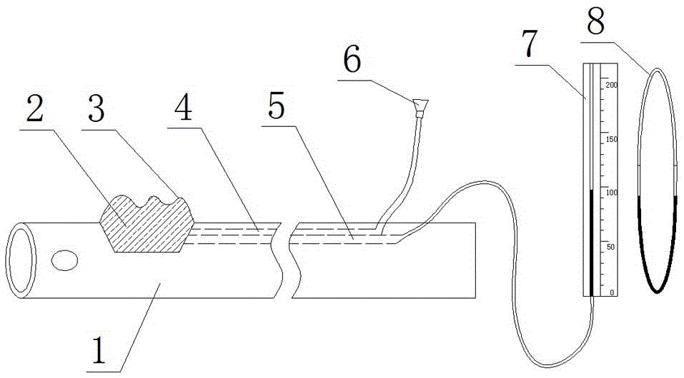 Pressure-measuring drainage catheter and pressure measuring method