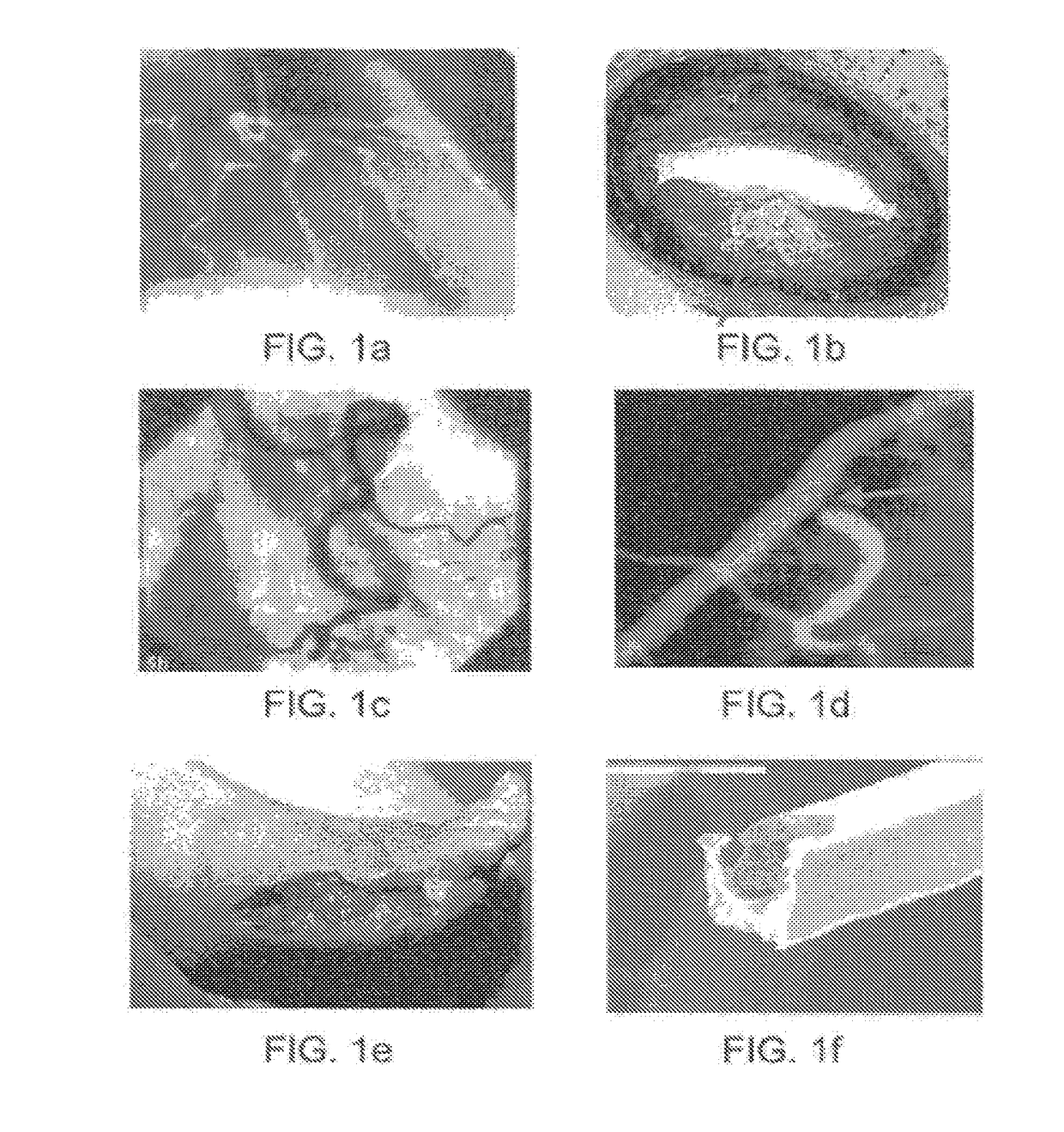 Apparatus and method for treatment of in-stent restenosis