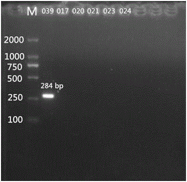 Specific nucleotides for citrobacter 017 and 039 and application of special nucleotides