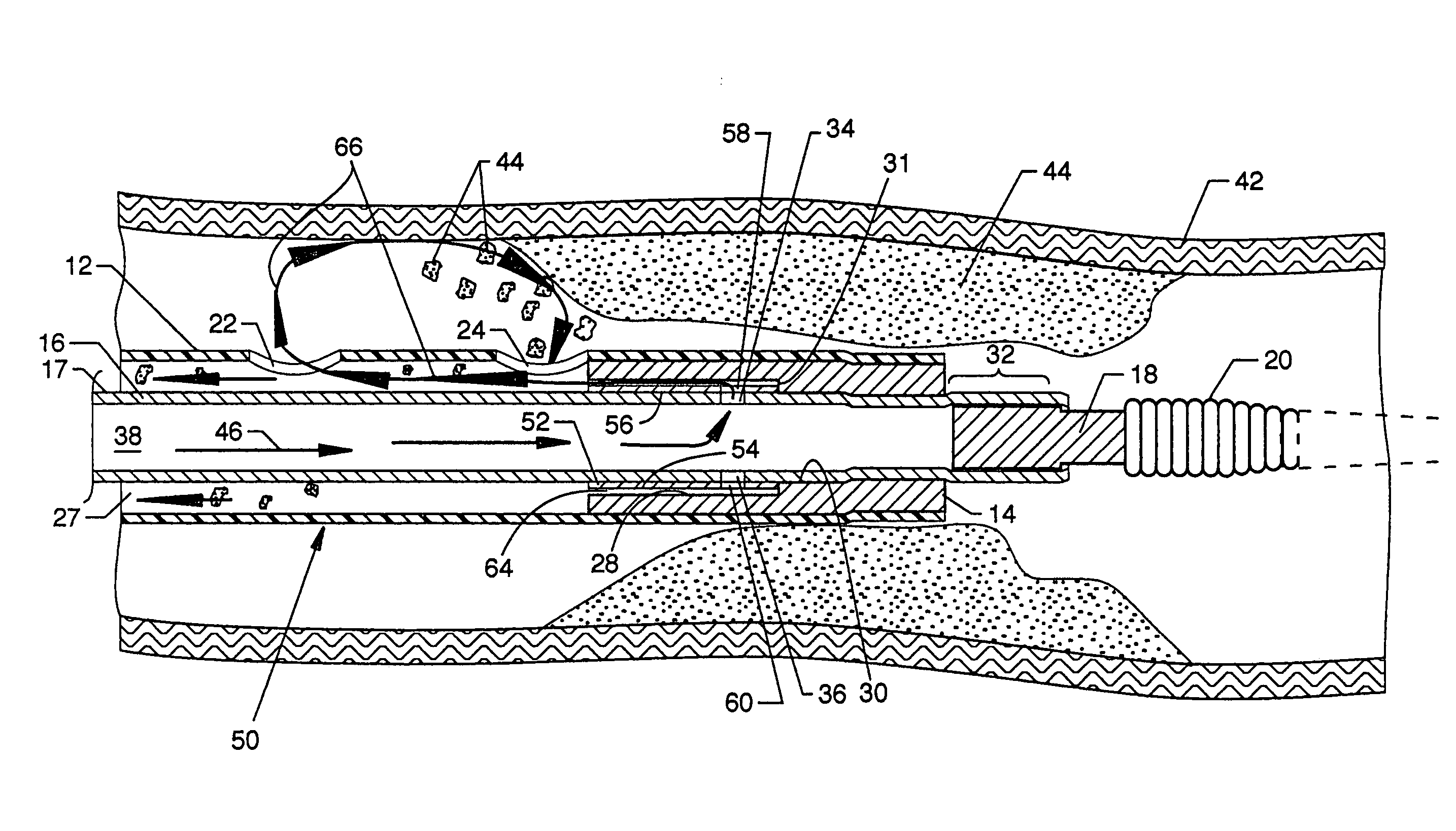 Miniature cross stream thrombectomy catheter