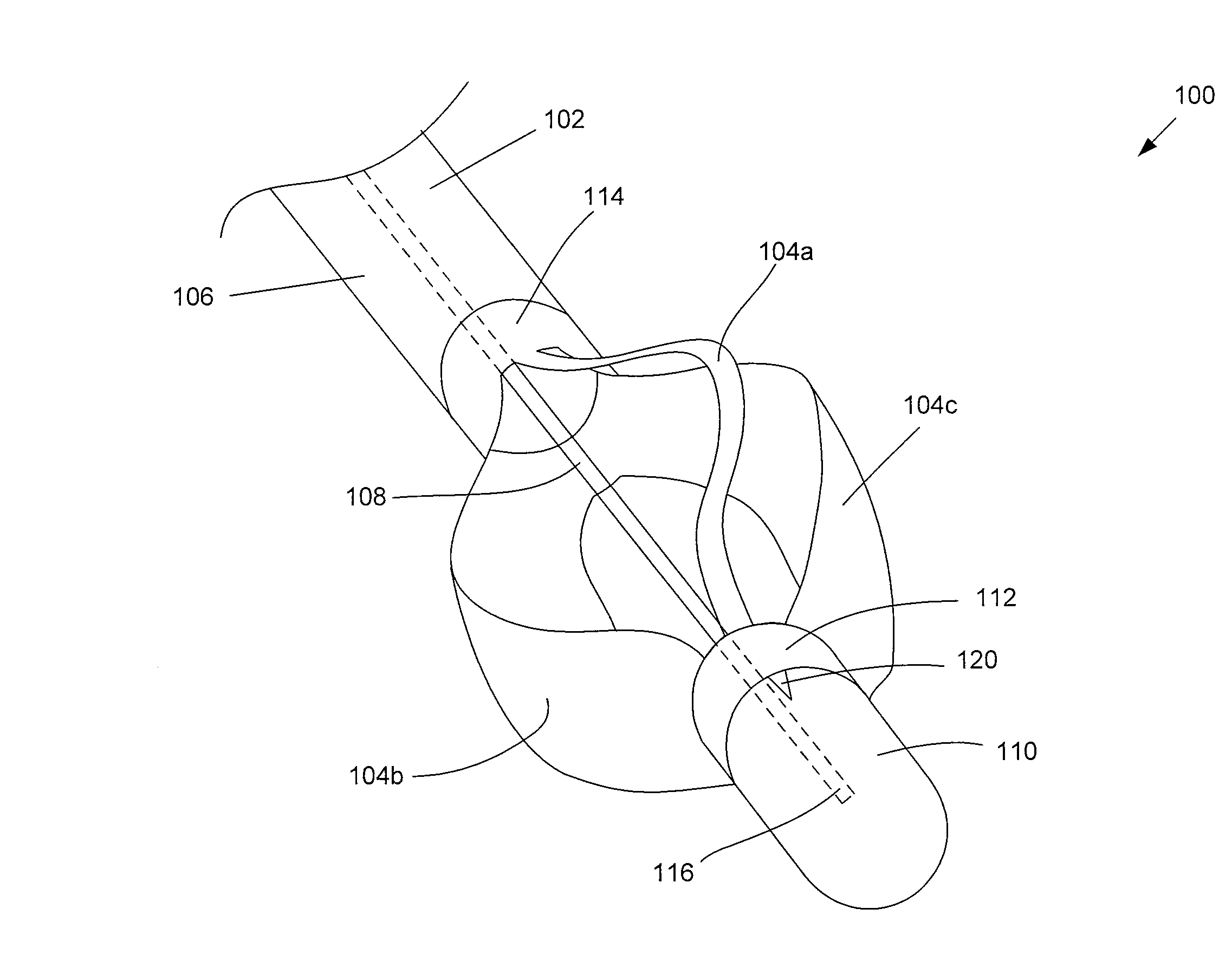 Sphincterotome having expandable tines