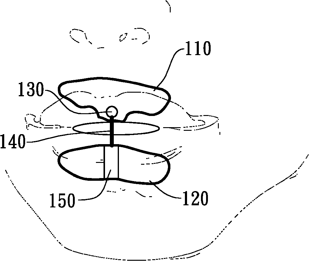 Mouth device and method of generating oral cavity negative pressure