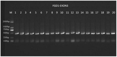 Primer and method for detecting FGD1 gene mutation