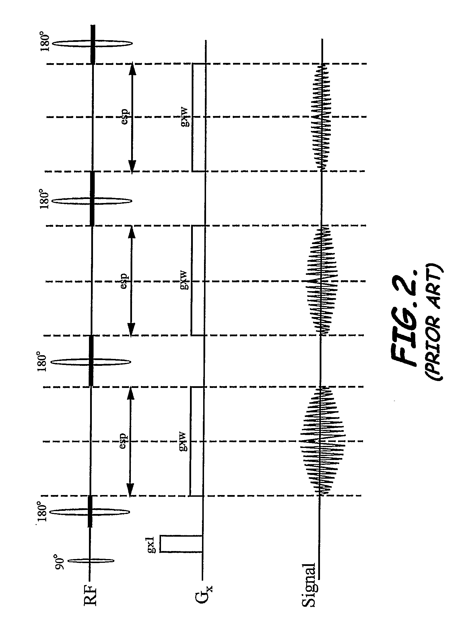 System, program product, and method of acquiring and processing MRI data for simultaneous determination of water, fat, and transverse relaxation time constants