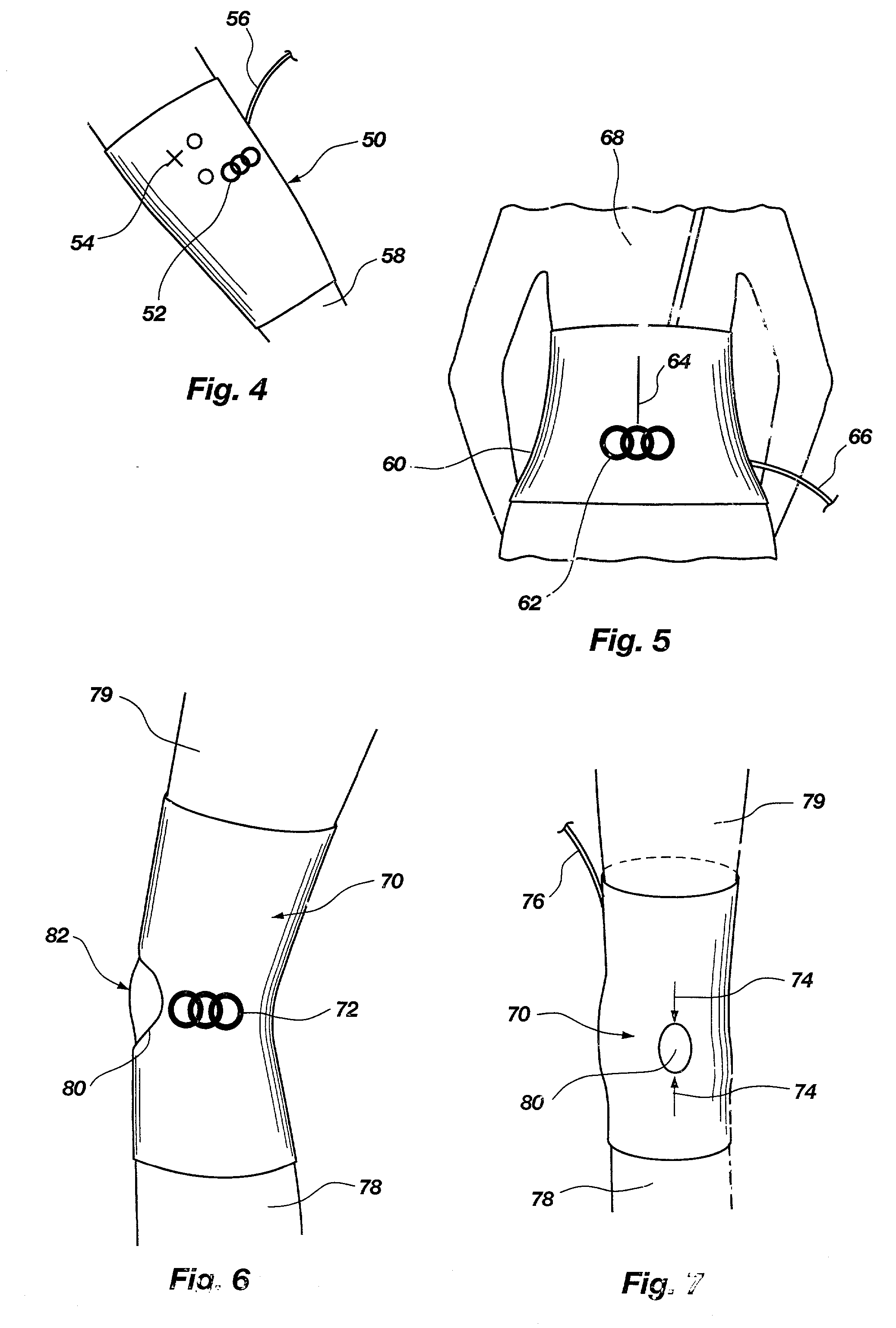 Method and apparatus for electromagnetic stimulation of nerve, muscle, and body tissues