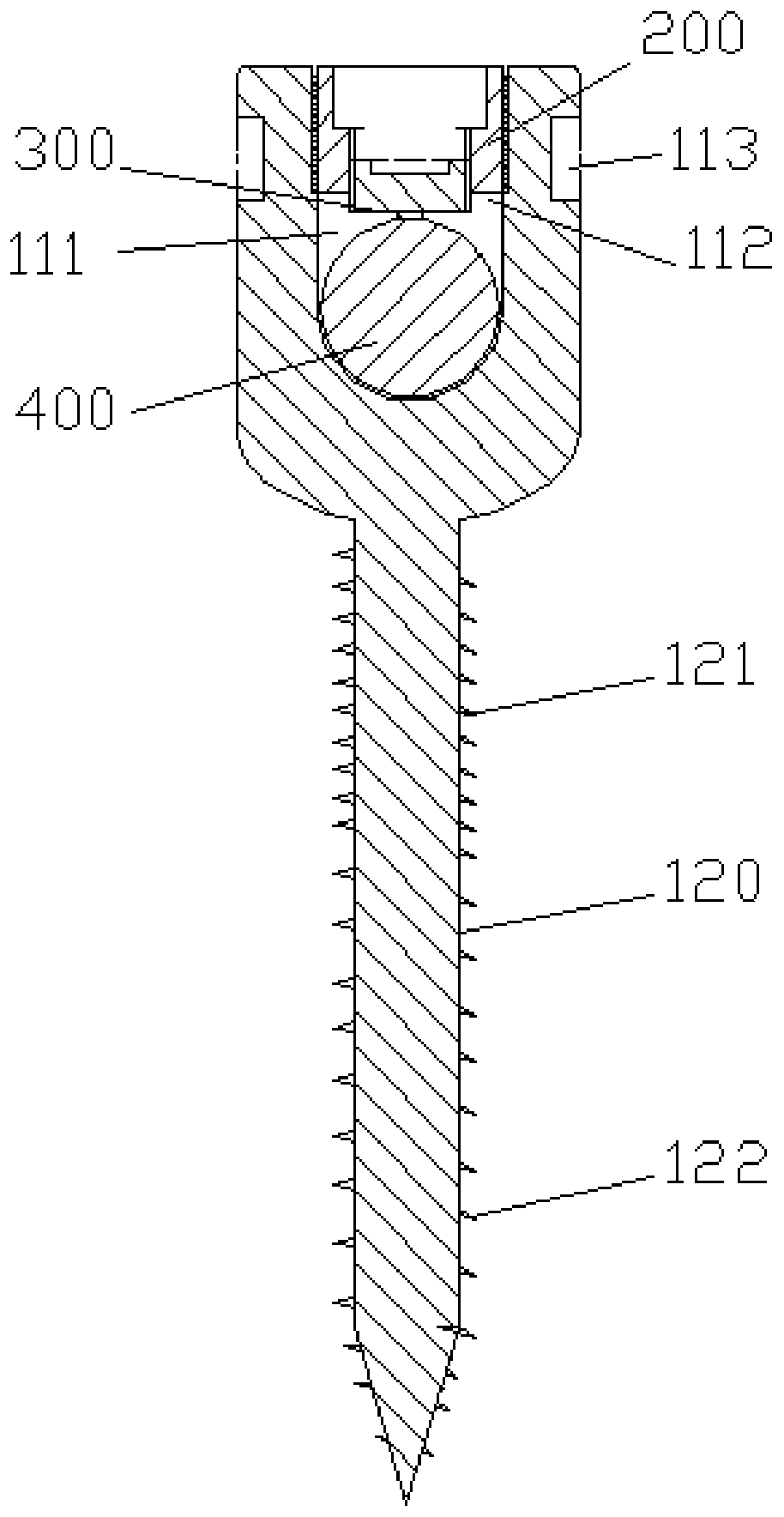 Pedicle screw fixation device and system for thoracolumbar spine posterior orthopedics