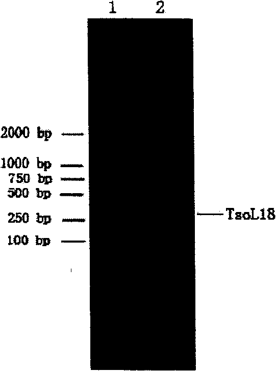 Cysticercosis cellulosae recombination gene, vaccin and preparation thereof