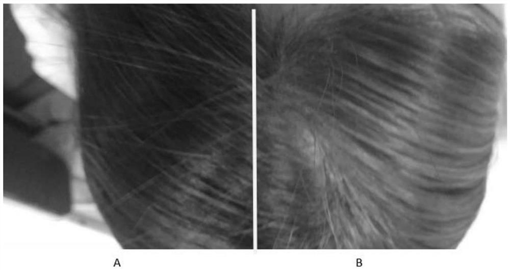 Deoiling powder for hair and preparation method thereof