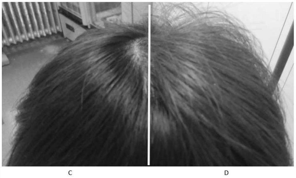 Deoiling powder for hair and preparation method thereof