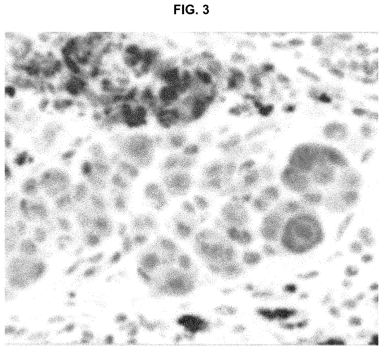 Methods and compositions for treatment of endothelin B receptor expressing tumors