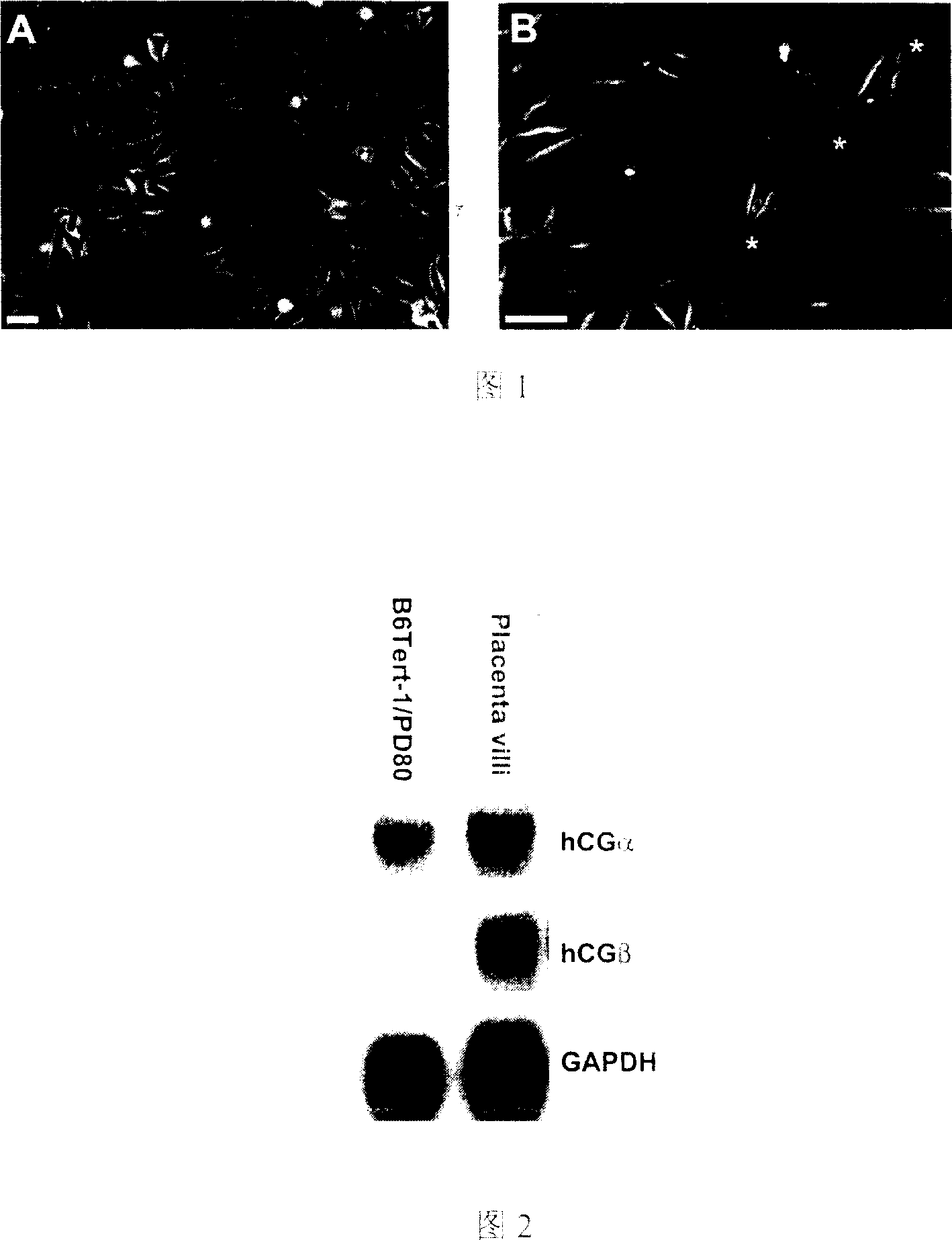 Human placental nutritive layer cell line and its use