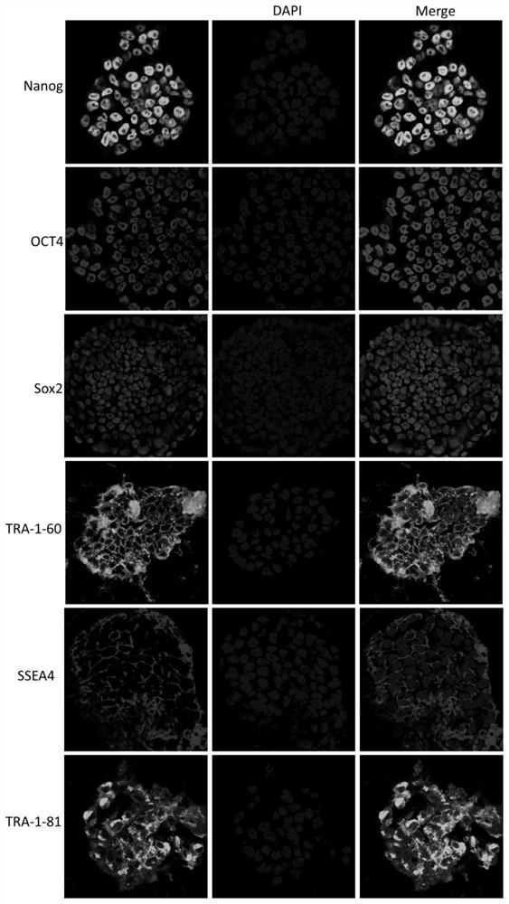 A kind of mesoderm lineage mesenchymal stem cell derived from pluripotent stem cell and preparation method thereof